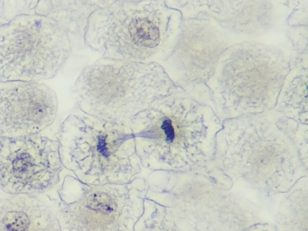 White Fish Mitosis Slides - White Fish Mitosis 05 400X